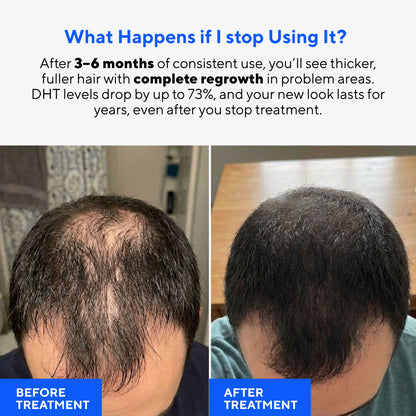 Glow Peptide Hair Regrowth System™