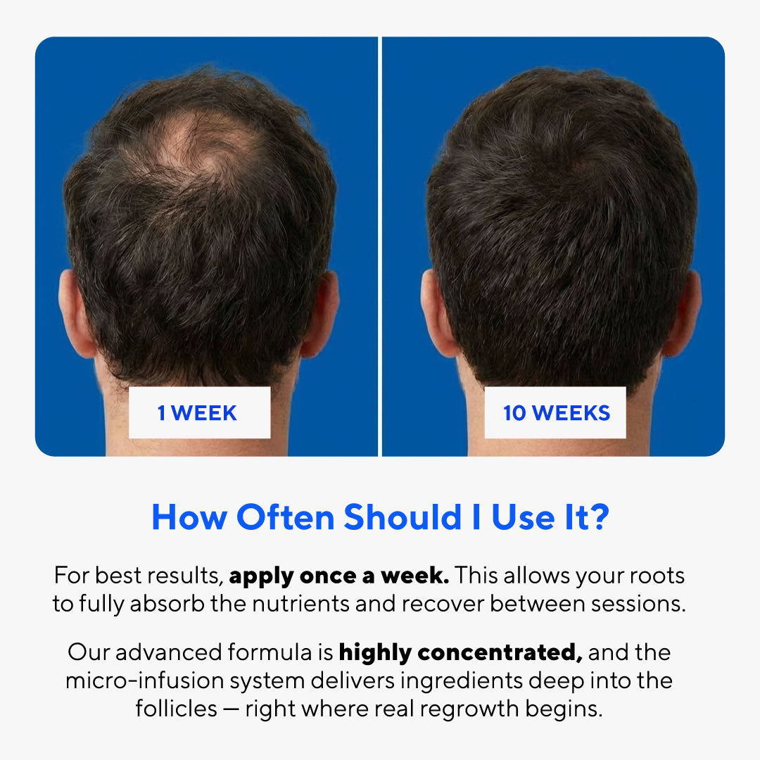 Glow Peptide Hair Regrowth System™