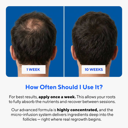 Glow Peptide Hair Regrowth System™