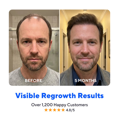 Glow Peptide Hair Regrowth System™